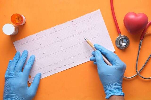Electrocardiograma a domicilio.